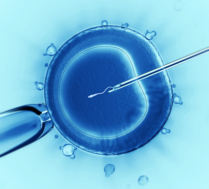 IVF IUI support in Portland